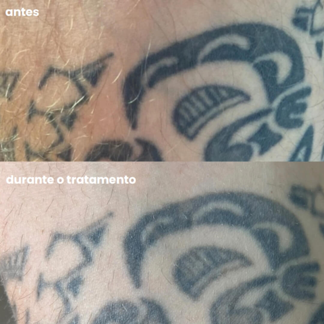 Design sem nome - 2025-08-07T145514.712 (1)