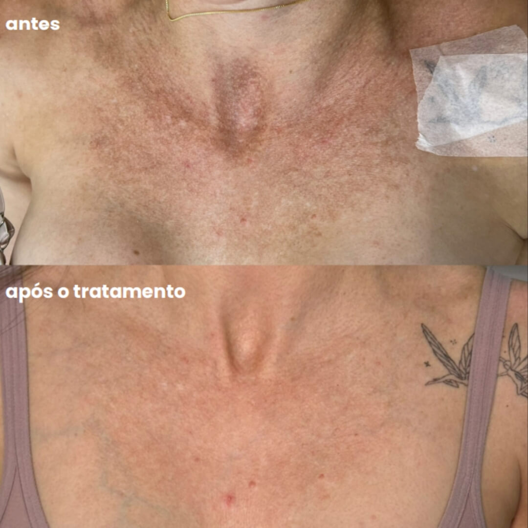 Design sem nome - 2025-08-07T151322.943 (1)