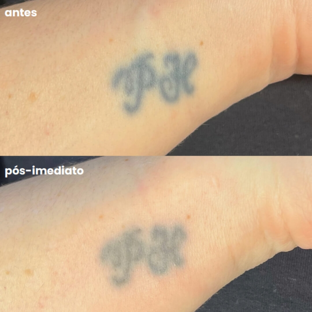 Design sem nome - 2025-08-07T152915.008 (1)