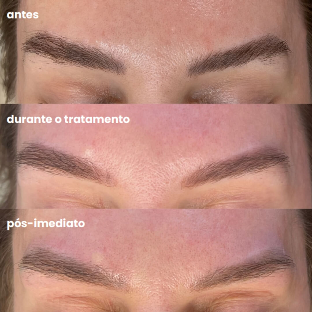 Design sem nome - 2025-08-07T153032.877 (1)