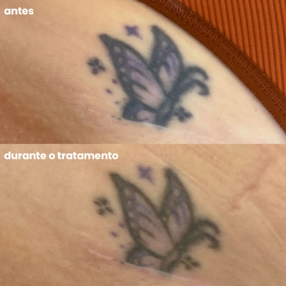 Design sem nome - 2025-08-07T160113.060 (1)